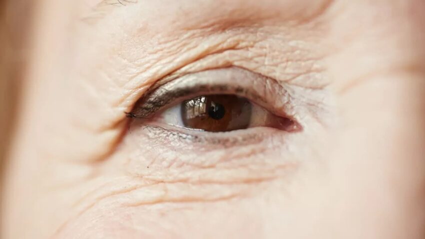 szemhéjkorrekció magánszemészeten